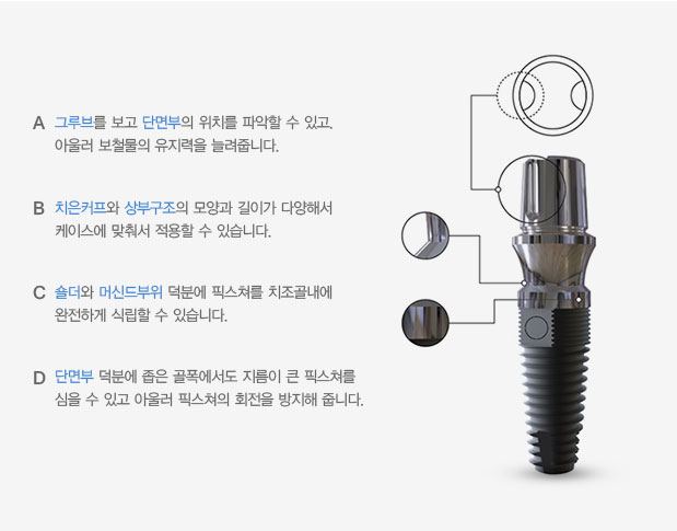 임플란트